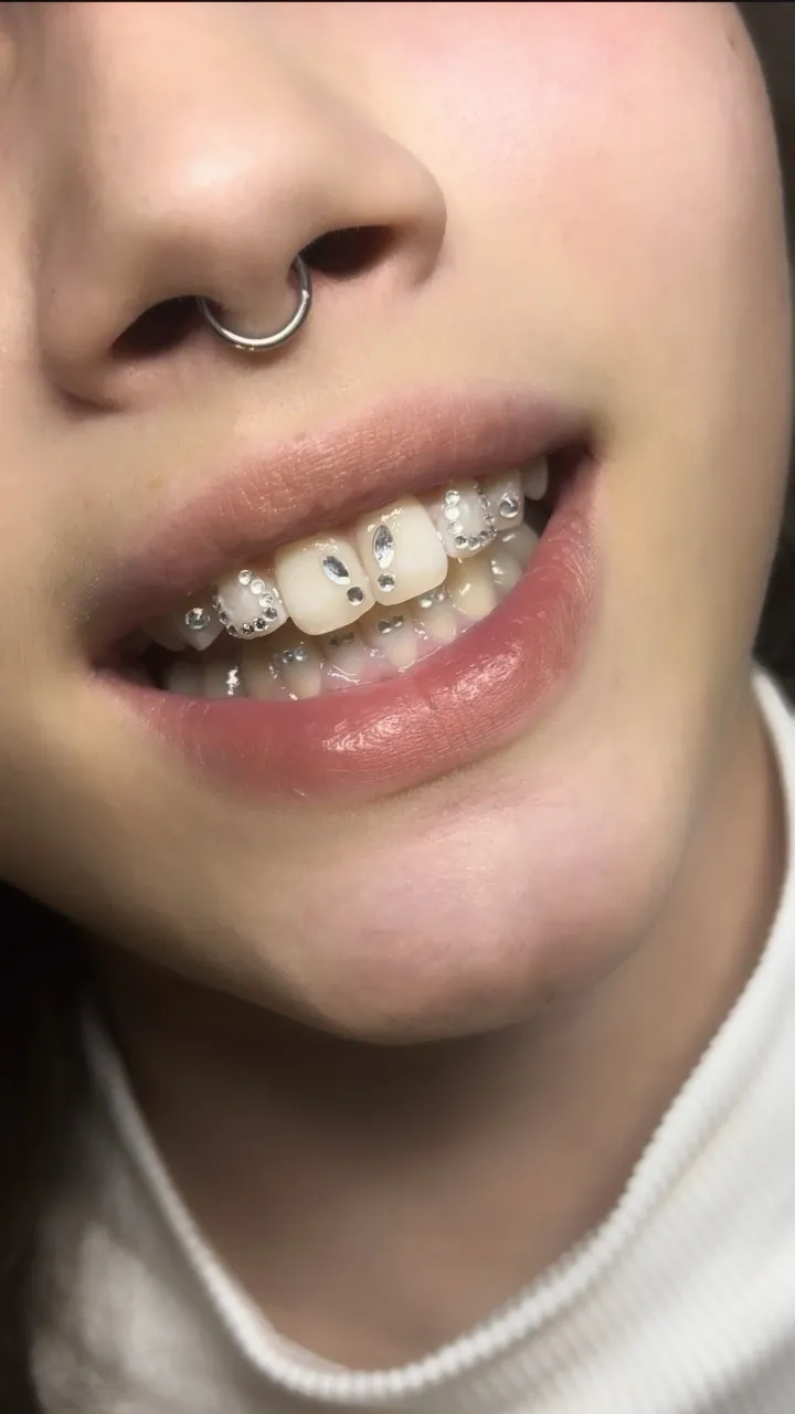 photo-16