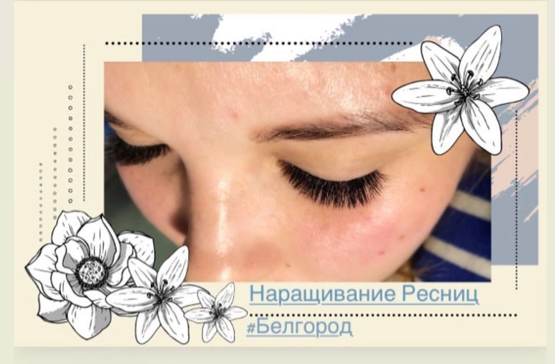 photo-2