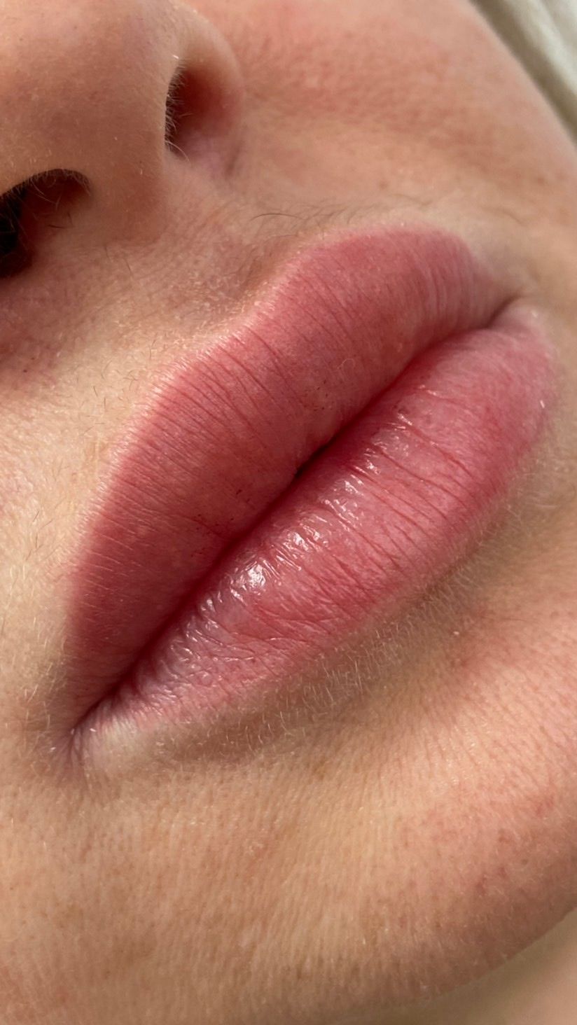 photo-2