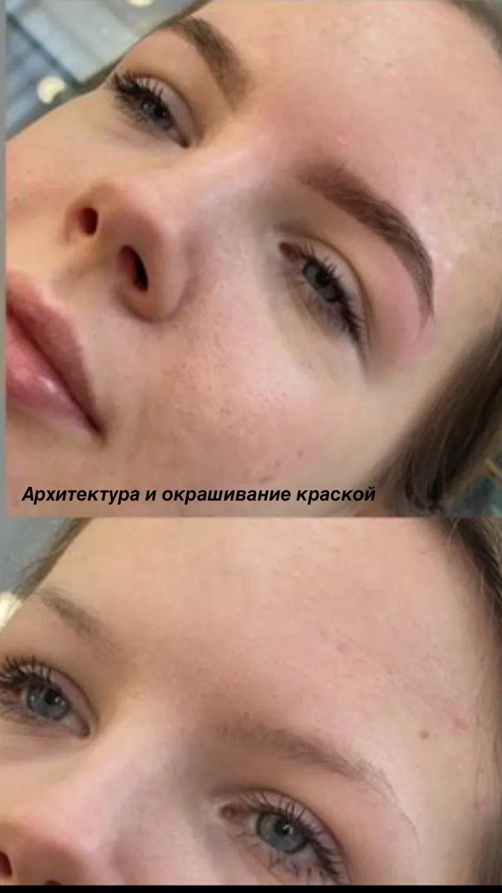 photo-3