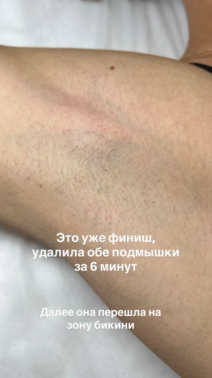 photo-3