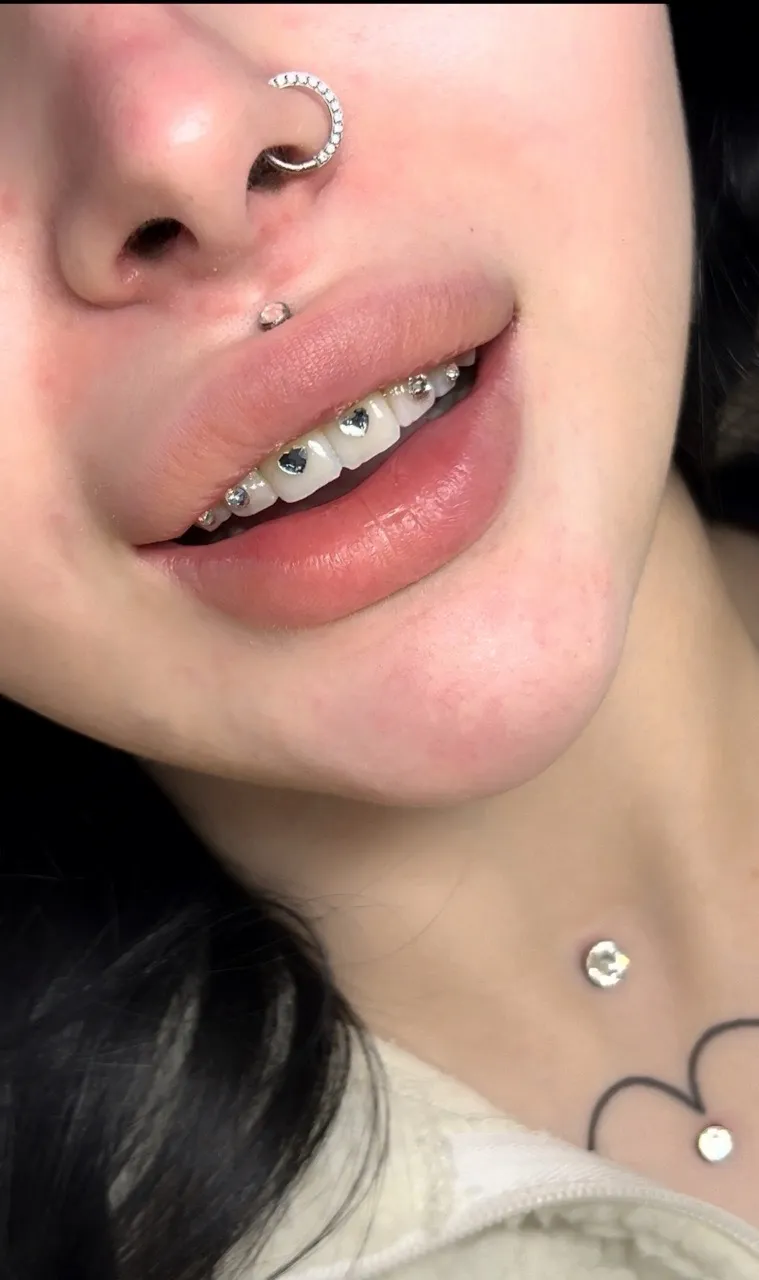 photo-18